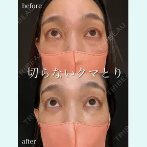 症例