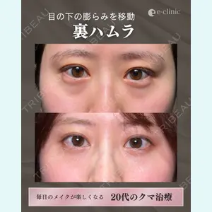 症例