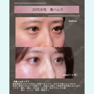 症例
