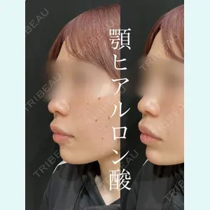 症例