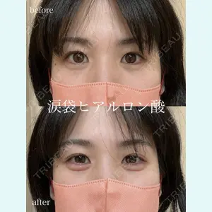 症例