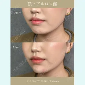 症例