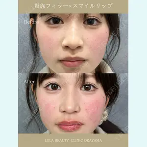 症例