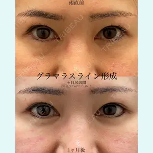 EMMO FACE CLINIC 大宮院 廣松 直樹医師の症例