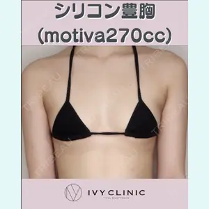 症例