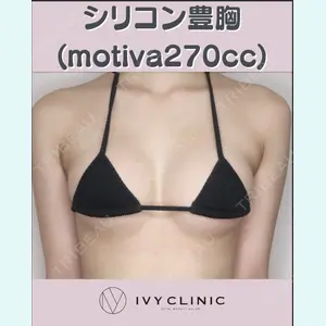 症例