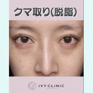 症例