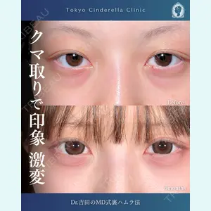 症例