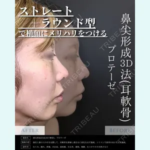 症例