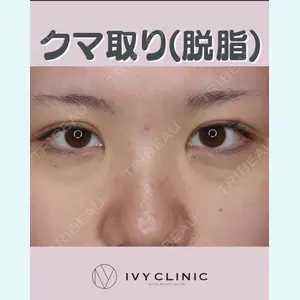 症例