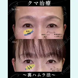 症例