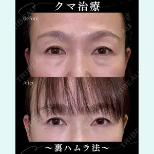 症例