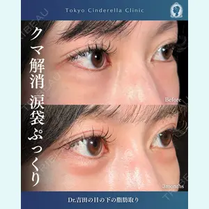 症例