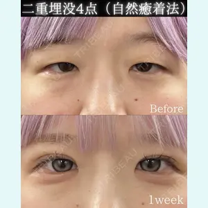症例