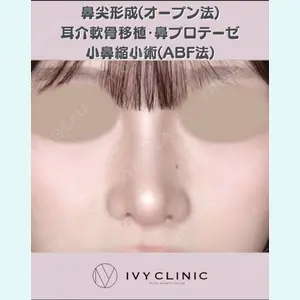 症例
