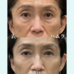 症例