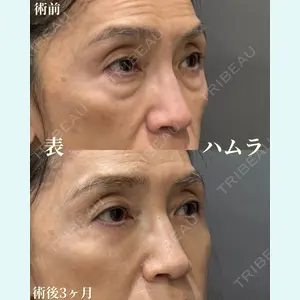 症例