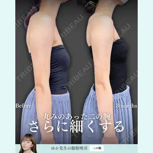 症例