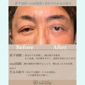 症例