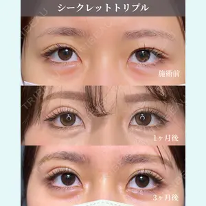 症例