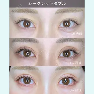 症例