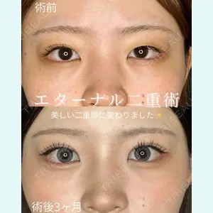 症例