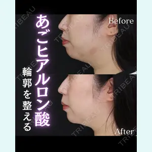 症例