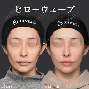 症例
