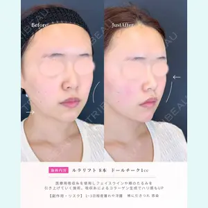症例