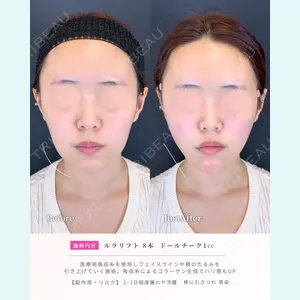 症例