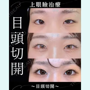 症例