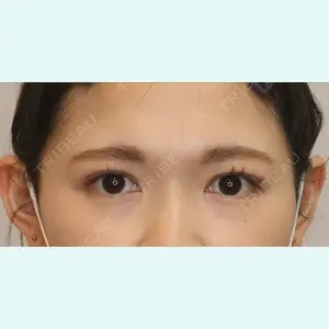 症例