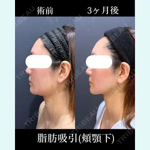 症例