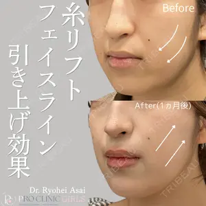 症例