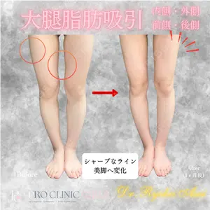 症例