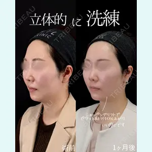 症例