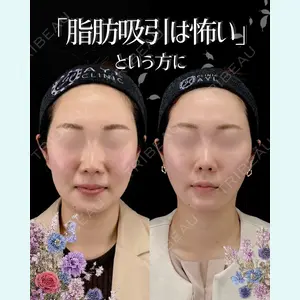 症例