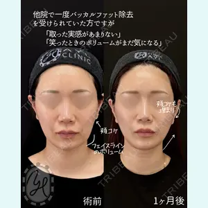 症例