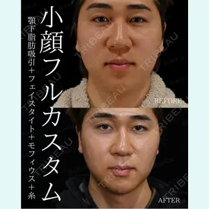 症例