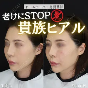 症例
