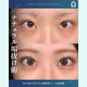 症例