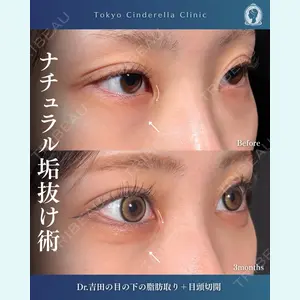 症例