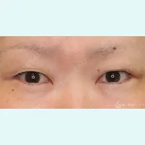 症例