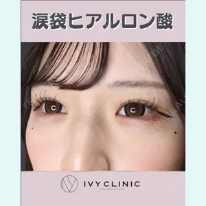 症例