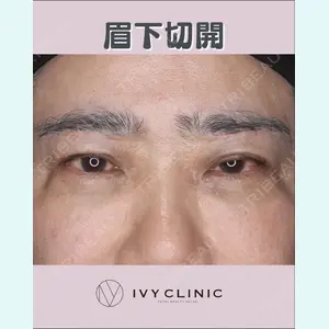 症例