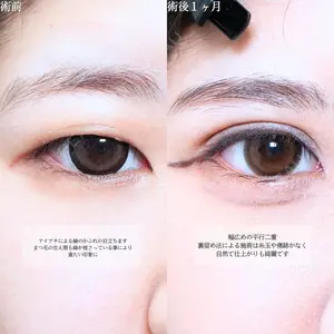 症例
