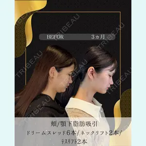 症例