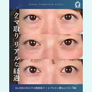 症例