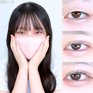 症例