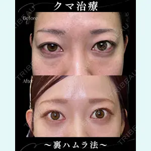 症例